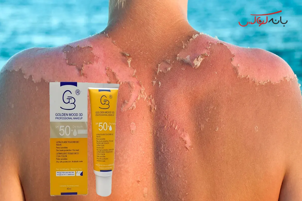 تاثیر ضد آفتاب در برابر سرطان پوست