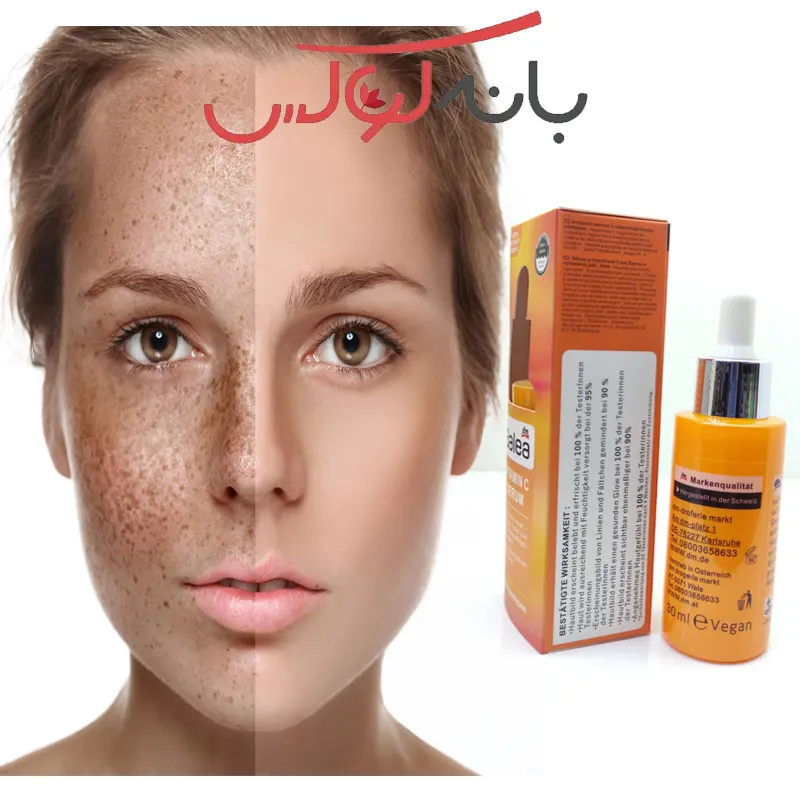 کاربرد و ویژگی های سرم باله آ