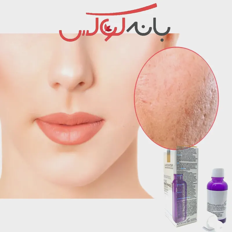 خرید سرم ضد لک و ضد پیری پوست حاوی 10% نیاسینامید خالص