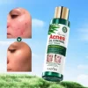 کاربرد تونر چای سبز سادور ضدجوش و آکنه ۱۲۰ میلی لیتر