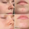 نحوه استفاده ماسک شب تغذیه‌کننده برنج کوزارکس